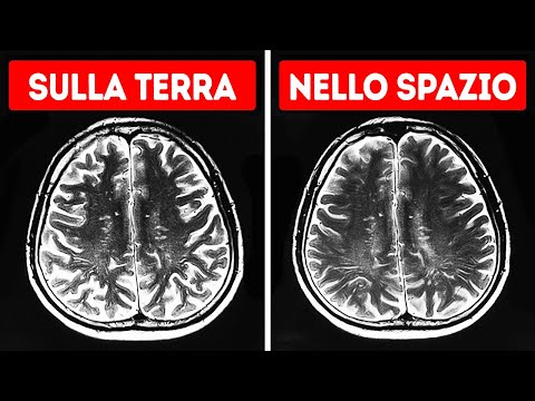 Lo Spazio ha un Effetto Strano sul Nostro Cervello e Altri 41 Fatti Fighi sul Corpo Umano