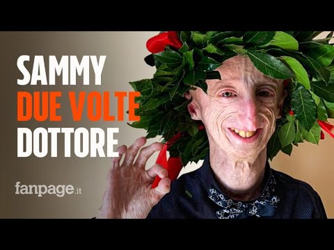 Sammy Basso, seconda laurea per il giovane affetto da progeria: è dottore in Molecular Biology