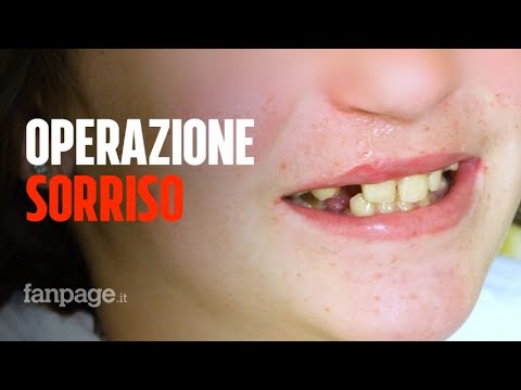 La Fondazione che aiuta i bambini nati con malformazioni a ritrovare il sorriso: “È una rinascita”