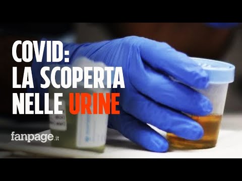 Un esame dell’urina dei pazienti Covid potrebbe prevedere chi rischia la forma grave dell’infezione