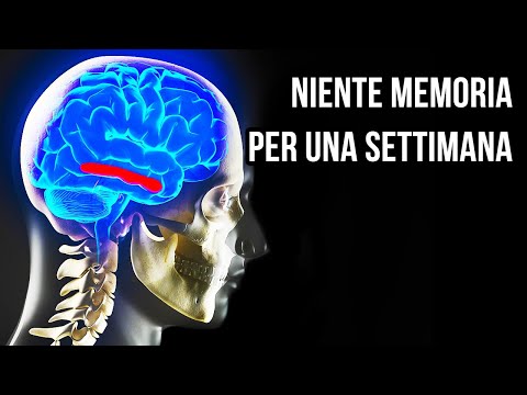 Che Succederebbe Se 8 Miliardi di Persone Perdessero la Memoria Tutte Insieme